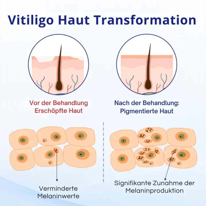 KUBOZN® Spray gegen Vitiligo — Dermatologisch getestet, pflanzlich & steroidfrei - Image 5