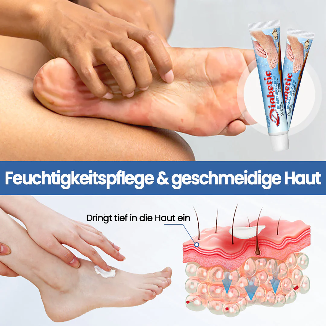 KUBOZN® VitaGluco Diabetes-Behandlungssalbe🌿 Dermatologisch getestet & empfohlen - Image 6